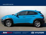 Hyundai KONA 1.6 CRDi - Anhängerkupplung - Hyundai KONA Diesel Gebrauchtwagen
