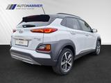 Hyundai KONA 1.6T DCT 4WD Premium Head-Up Leder Navi DL - Hyundai KONA Gebrauchtwagen in Dresden