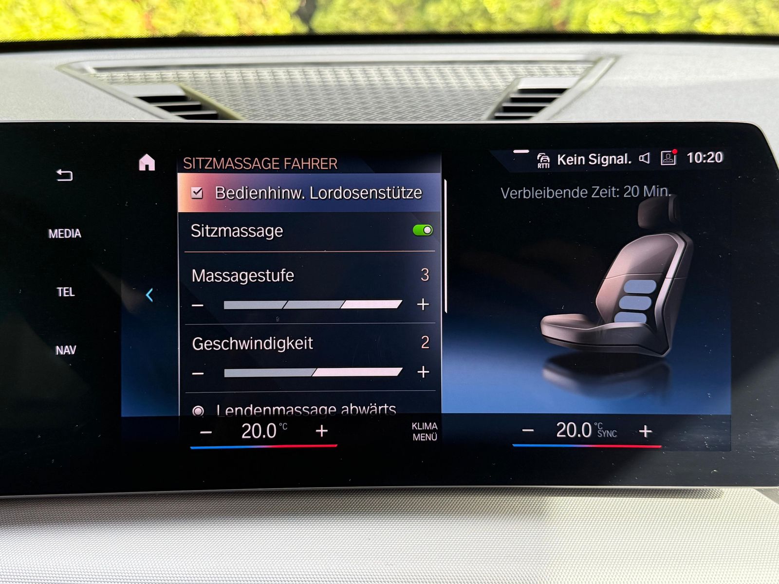 Fahrzeugabbildung BMW iX1 30 xDrive 64 kWh SHADOW+LIFE+SHZ+KAM+LEDER+M