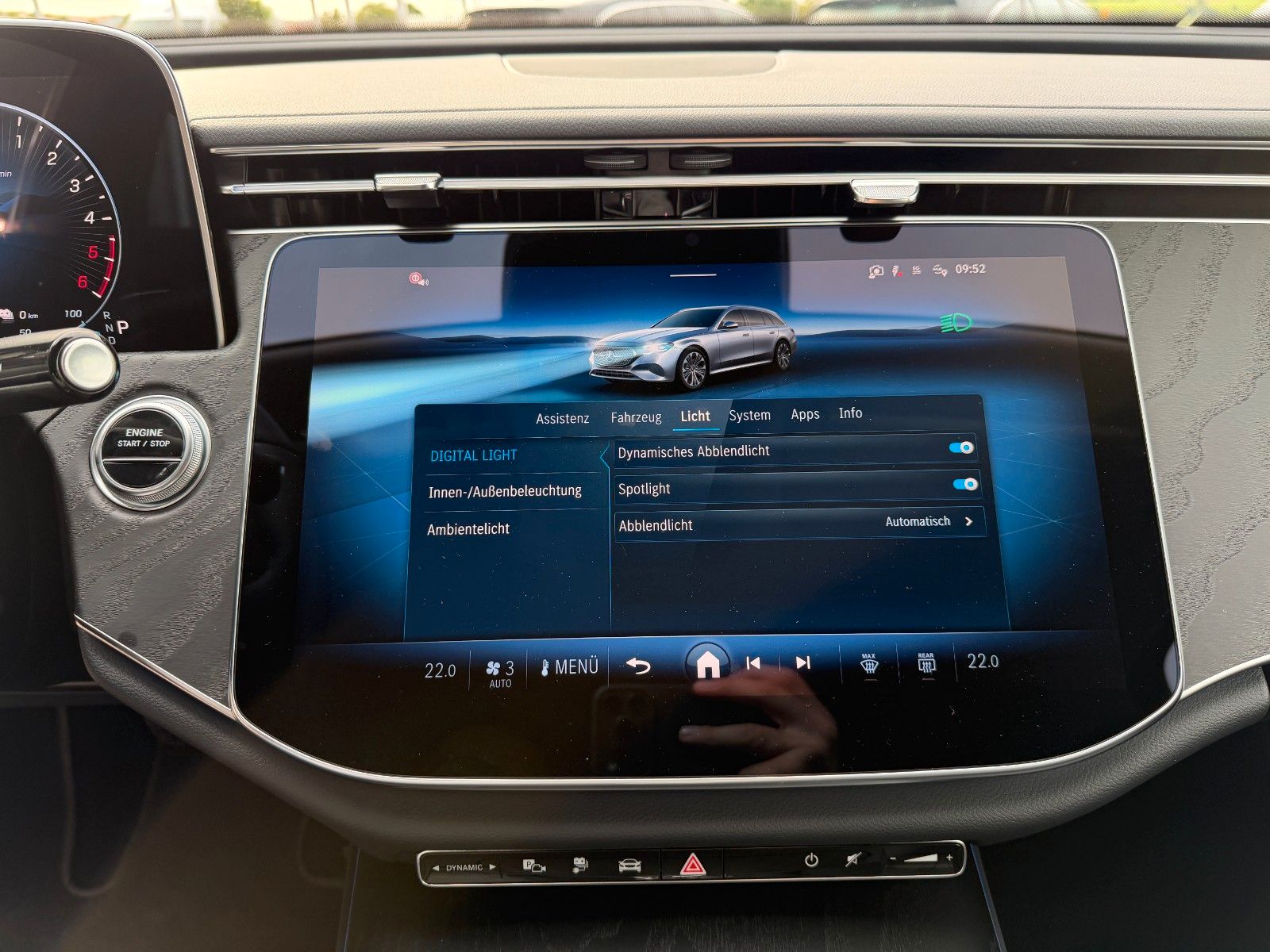 Fahrzeugabbildung Mercedes-Benz E 300de Avantgarde AHK+Distr+Memory+360+DigitalL