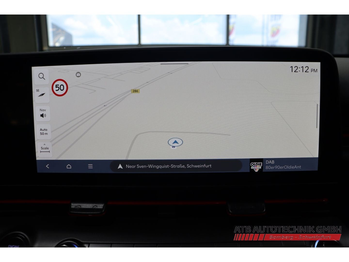 Fahrzeugabbildung Hyundai KONA MY26 N-Line Hybrid 1.6 GDI 138 PS DCT 2WD