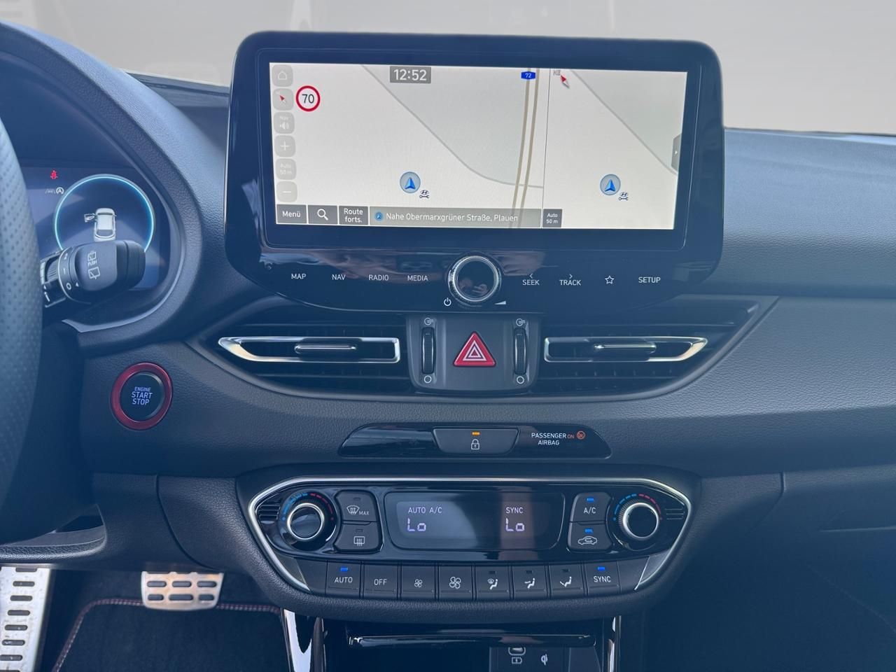 Fahrzeugabbildung Hyundai i30 N-LINE *CARPLAY*NAVI*BT*SHZ*LHZ*