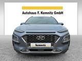 Hyundai Kona Style / Klimaauto / Kamera / DAB / AHK - Hyundai KONA Gebrauchtwagen in Hamburg