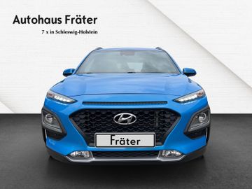 Fotografie des Hyundai Kona Style 2WD Navi/ DAB / Automatik