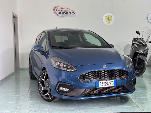 Ford Fiesta 1.5 Ecoboost 200 CV 3 porte ST