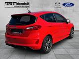 Ford Fiesta ST-Line X 125PS LED B&O ACC Garantie - Ford Fiesta: ST X